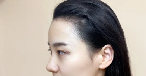女性額頭寬大發(fā)際線高面相好不好？