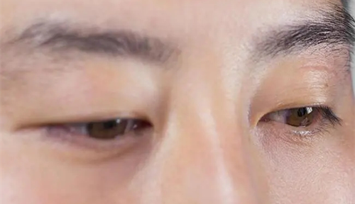 男人的左眼跳是什么預(yù)兆 男人左眼跳是財還是災(zāi)
