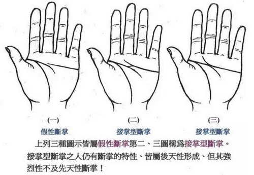 感情線(xiàn)與智慧線(xiàn)相連但又不是斷掌